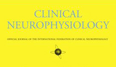 Joint research of HIT and TSMC was accepted to  "Clinical Neurophysiology" magazine